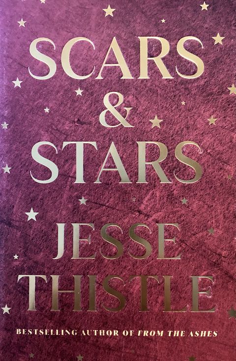 Scars and Stars